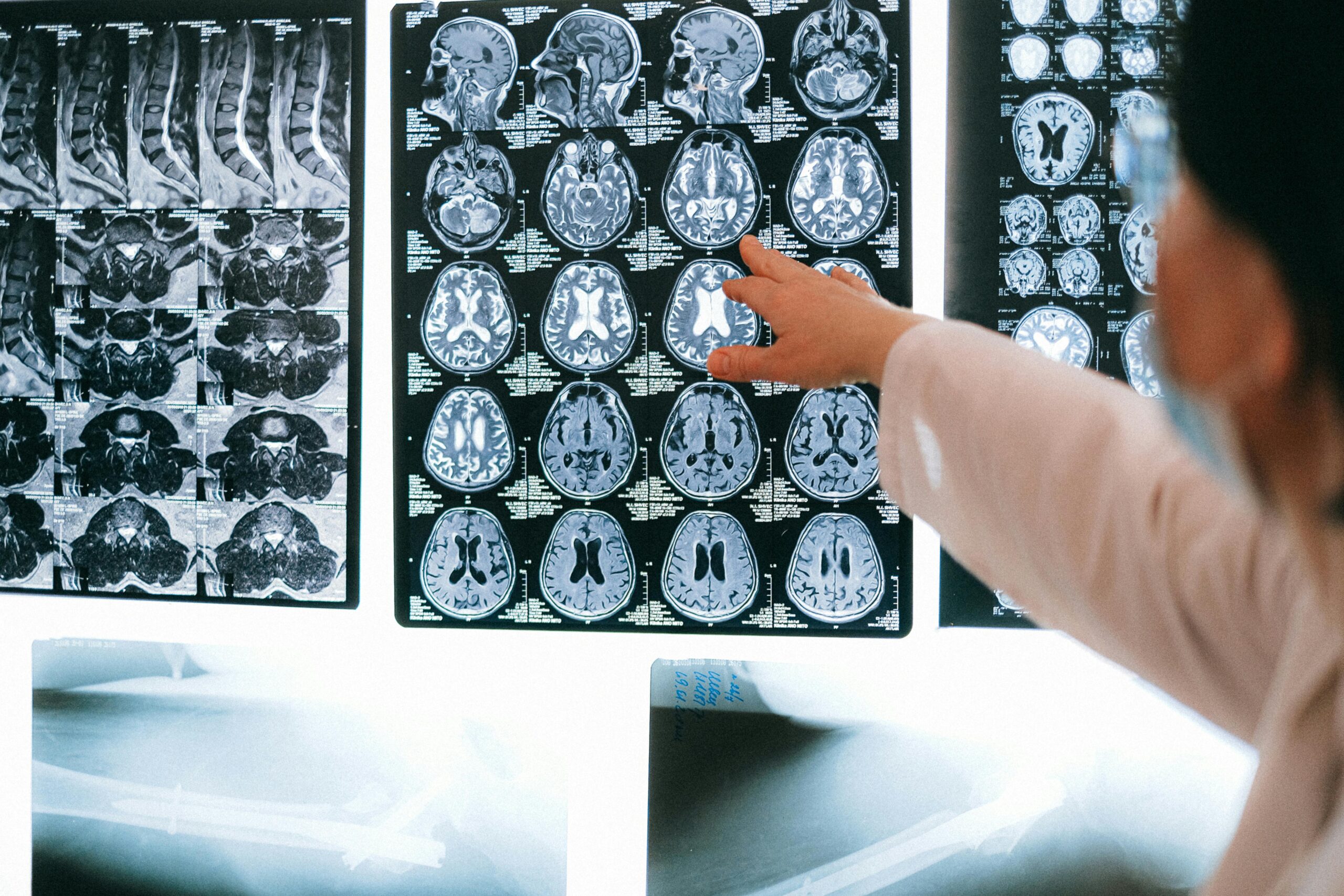 neurological nerve conditions