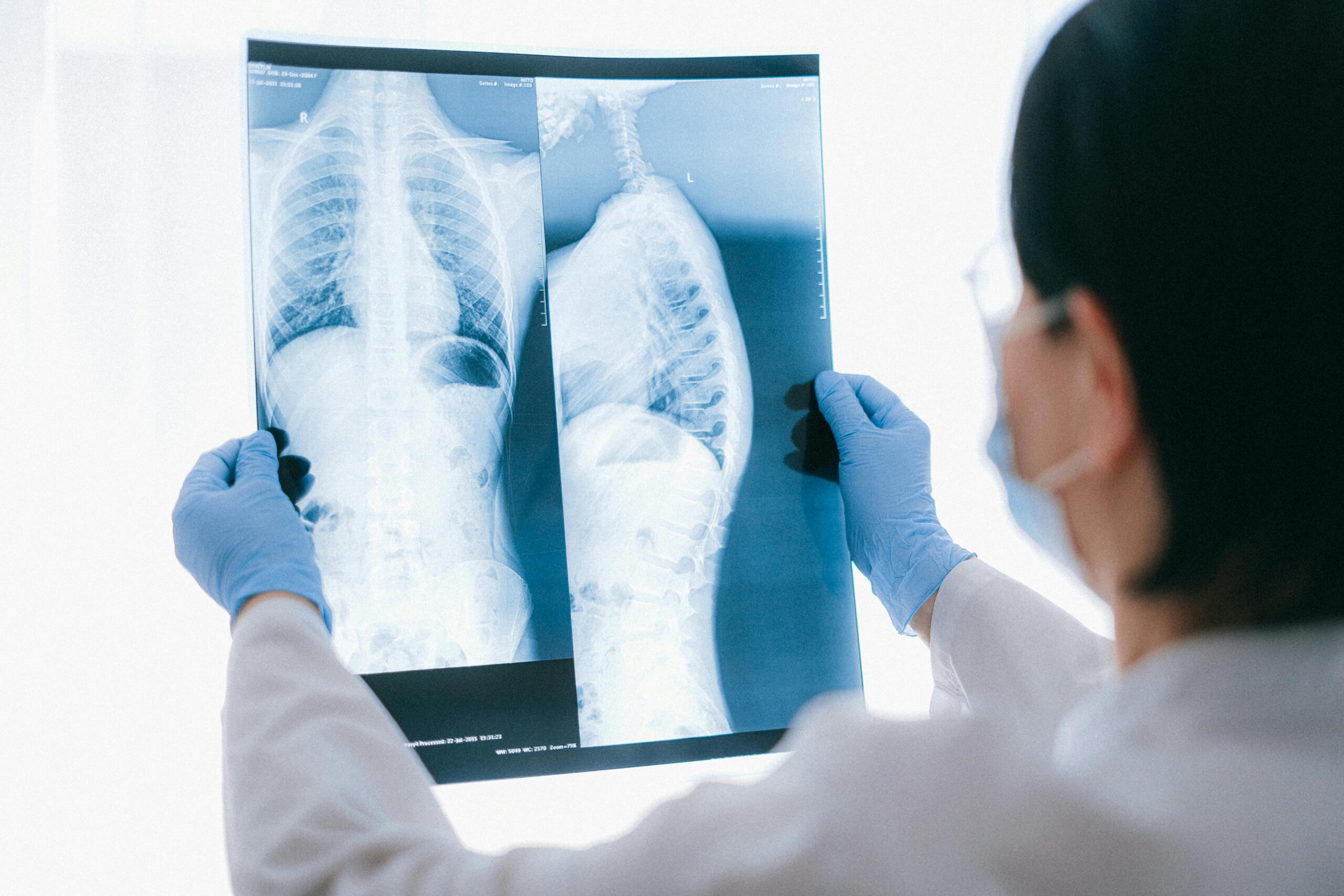 pulmonary lung conditions