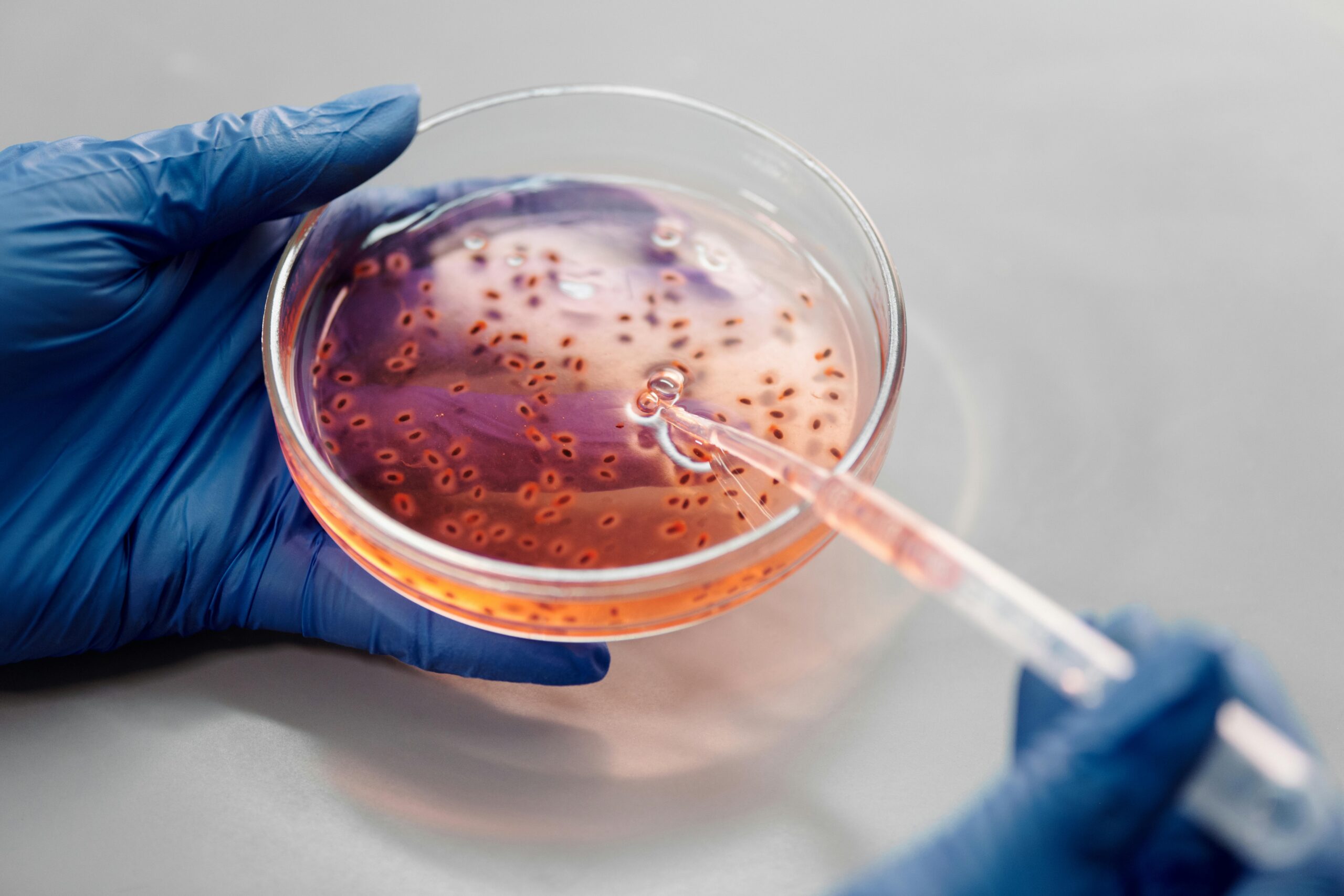 antibiotics petri dish
